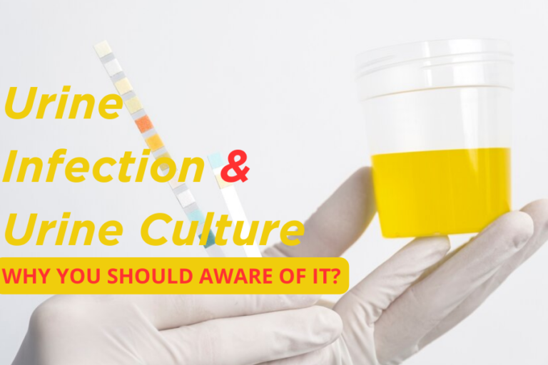 Urine Infection and Urine Culture: Why You Should Aware of it?