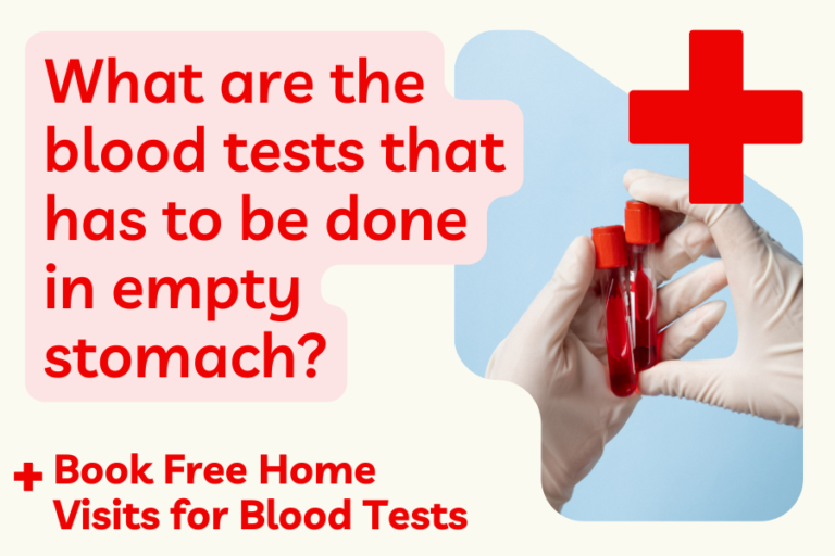 What Are the Blood Tests That Have to Be Done on an Empty Stomach?
