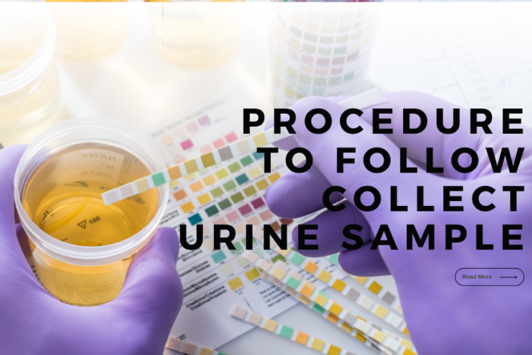 Step-by-Step Guide: How to Properly Collect a Urine Sample for Accurate Results