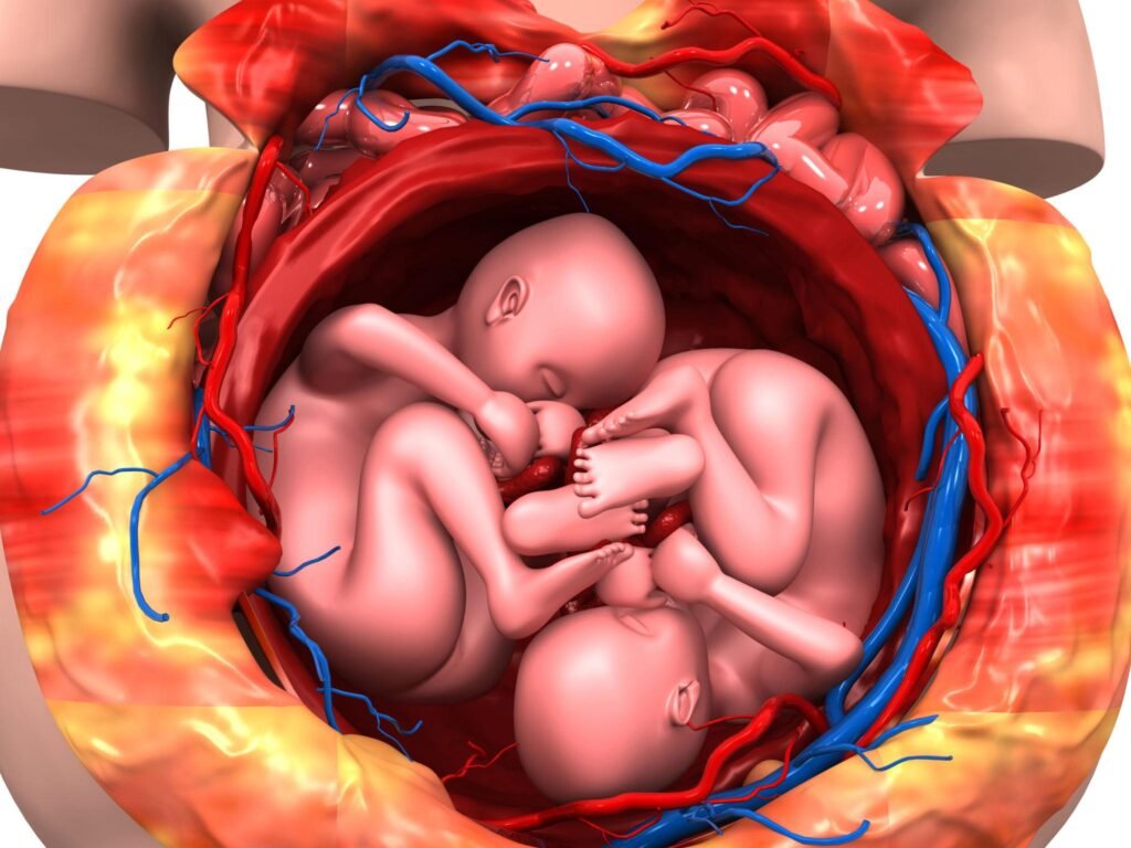 Twin babies attached in the womb