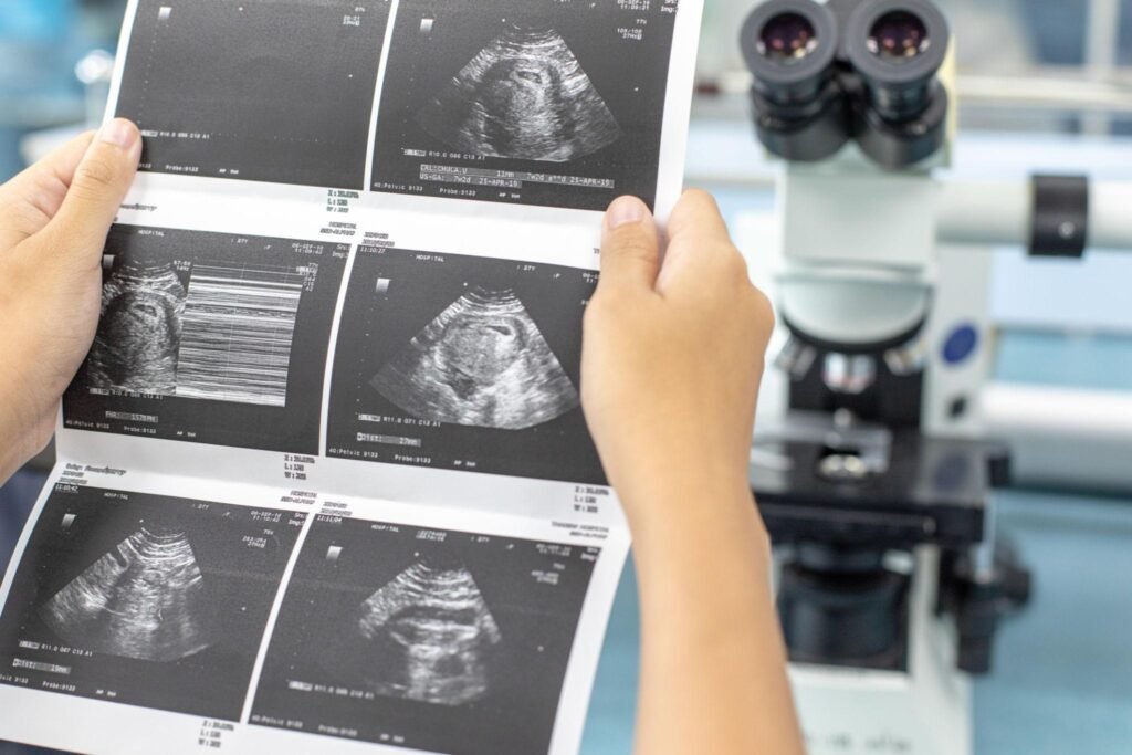 Pregnancy Scan in Bangalore