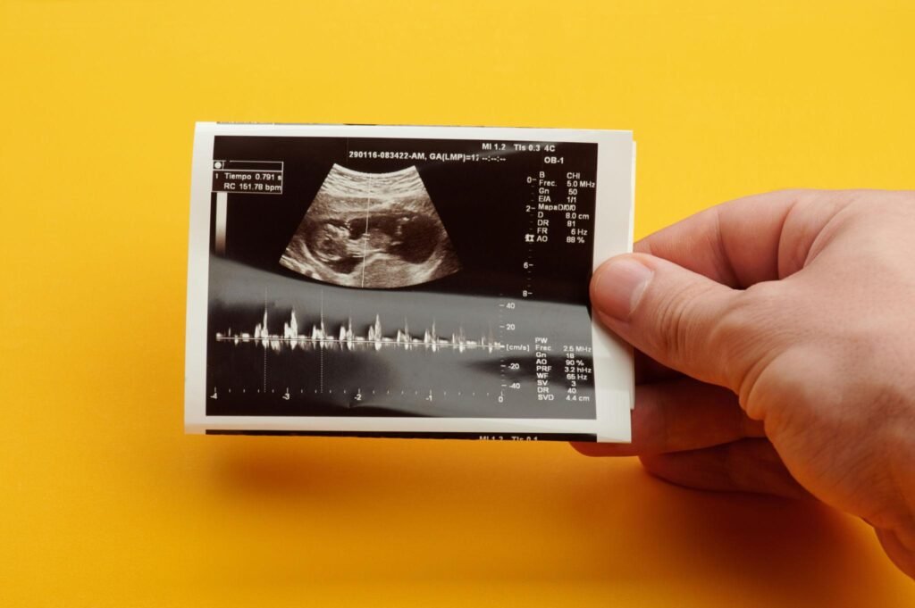 Dating Scan in Pregnancy