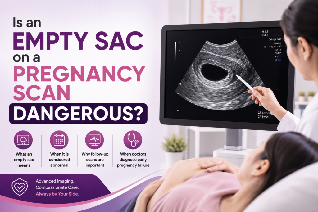 Empty Sac on Pregnancy Scan