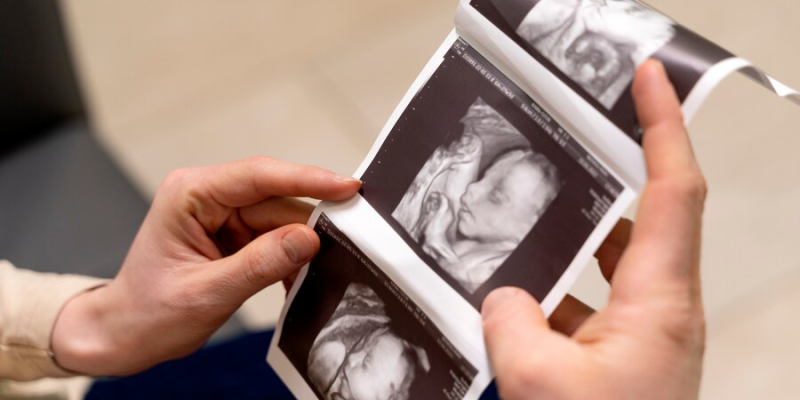 Why follow the Pregnancy ultrasound scan schedule